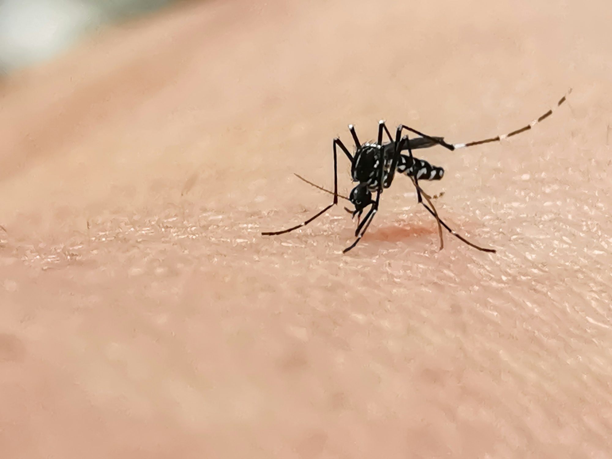 Mosquito bite.